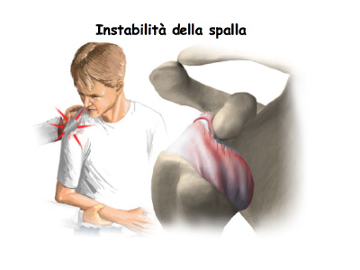 LUSSAZIONE E INSTABILITÀ DI SPALLA ORTOPEDICO ROMEO